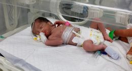 Baby girl rescued from mother’s womb dies | Israel War on Gaza