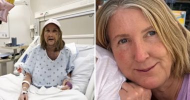 California woman's mouth wired shut after attack in ritzy waterfront neighborhood